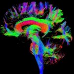 Magnetic resonance image of an infants brain