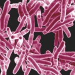 Microscopic view of a tropical disease