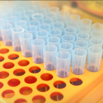 rack of plastic test tubes